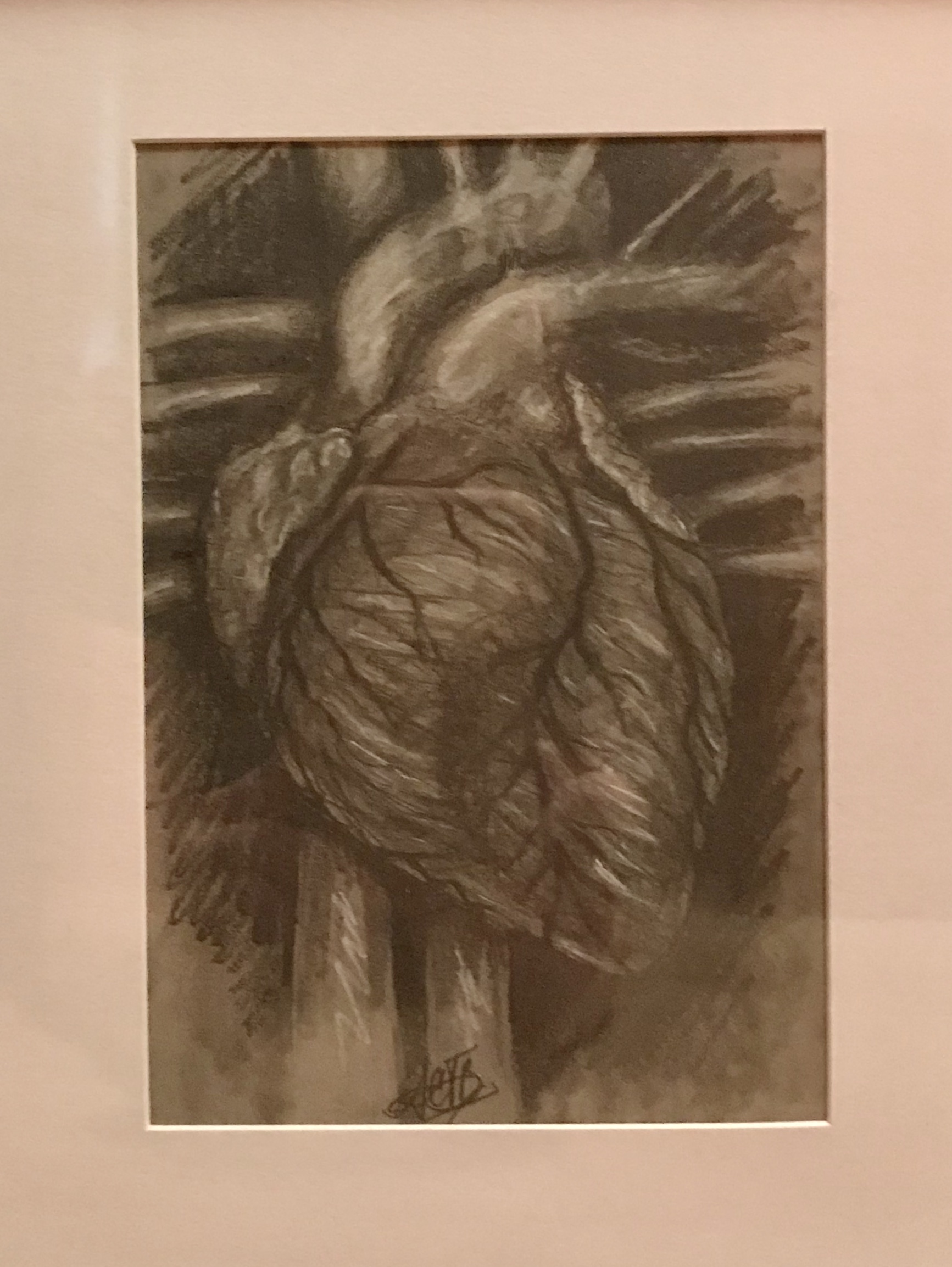 Black and white anatomical heart