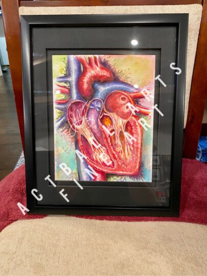 Watercolor of anatomical heart dissection.